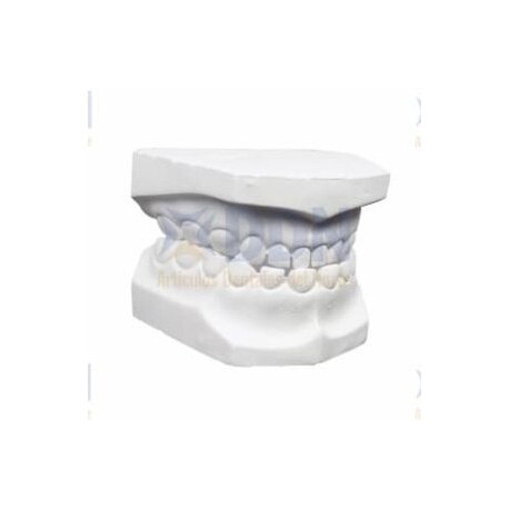MODELO DE YESO INFANTIL